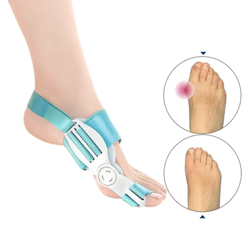 Correcteur de Hallux Valgus
