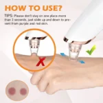 Aspirateur Electrique de Points Noirs