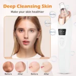 Aspirateur Electrique de Points Noirs