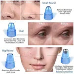 Aspirateur de Points Noirs XN-8030